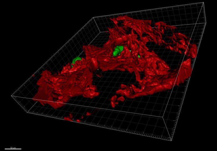 3D image showing the invasion of breast cancer cells (green) expressing ZEB1...
