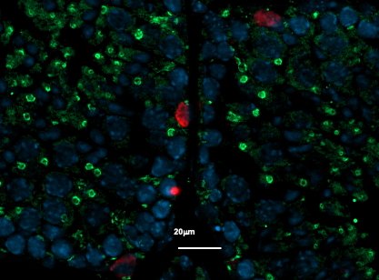 Immunostaining of a mouse testicle section, with (in red) the undifferentiated...