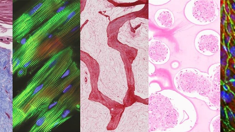 Tissues cultured in the multi-organ chip (from left to right: skin, heart,...