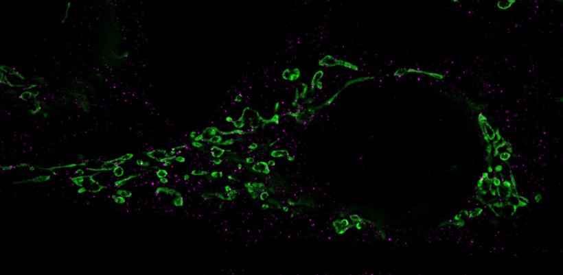 Fragmentation of mitochondria (green): The Drp-1 proteins responsible for the...