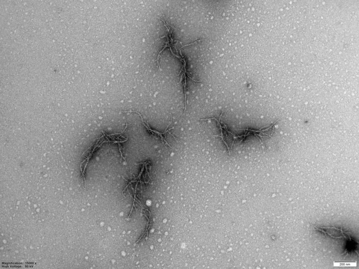 Picture of amyloid from the SARS-CoV-2 virus’ spike protein. Seen using an...