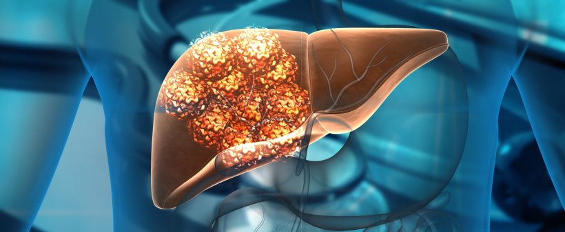 Human liver cancer cell growth 3d illustration