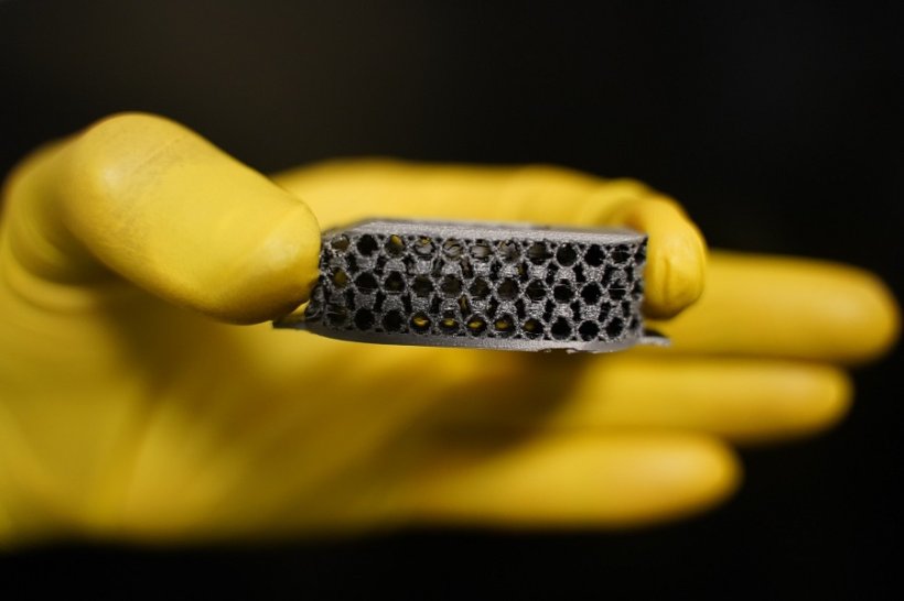 3D printed implant.