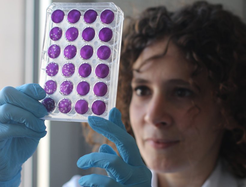 Meriem Bekliz, first author, with a plaque-reduction neutralization assay used...