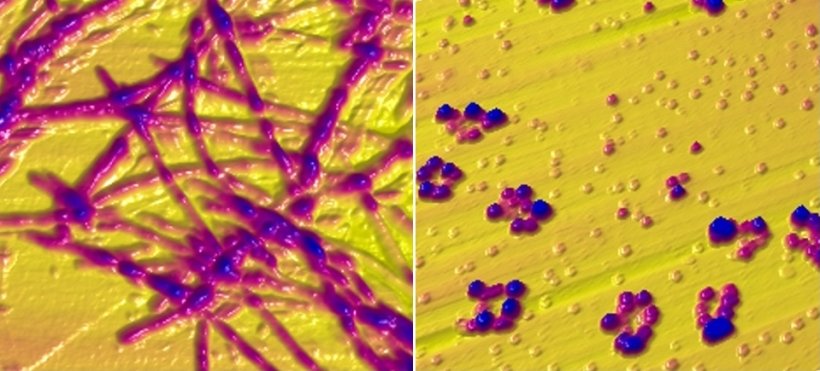 Images taken with an atomic force microscope show alpha-synuclein in the form...