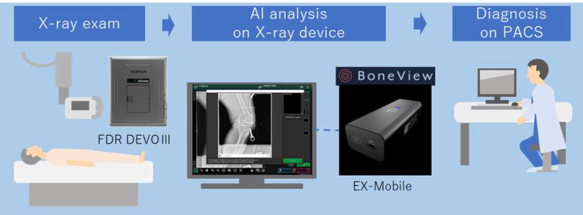 AI software to help identify bone trauma at the point of care