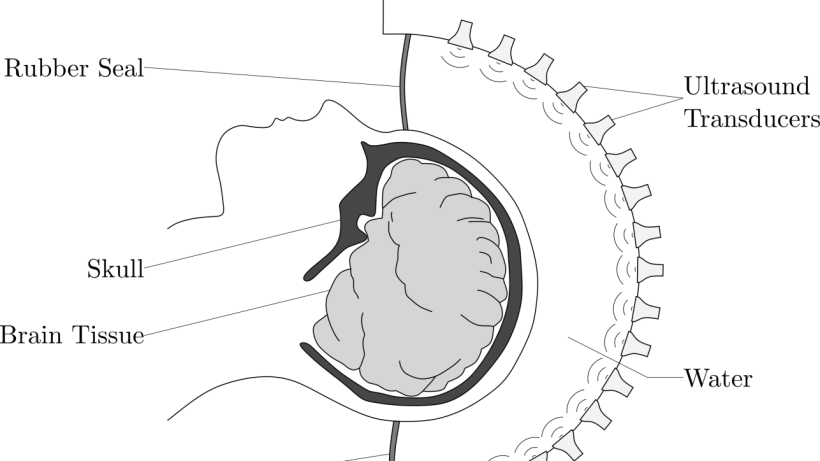 Mit Ultraschallwellen das Gehirn untersuchen