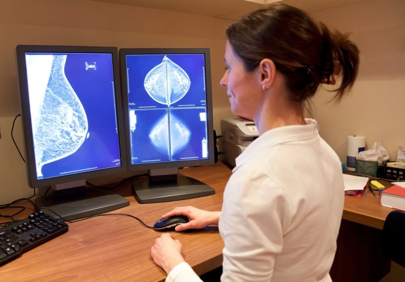 female medical professional looking at mammogram on screens
