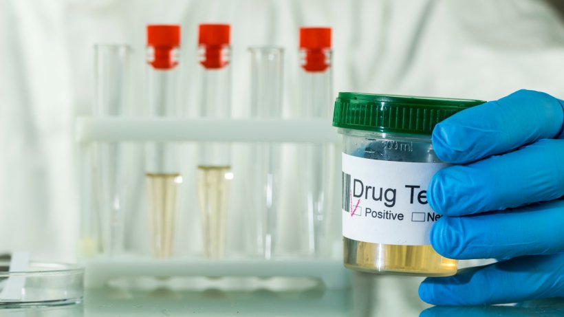 The complexities of drug testing in urine and hair