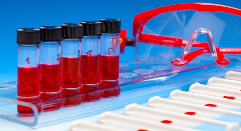 array of blood test tubes