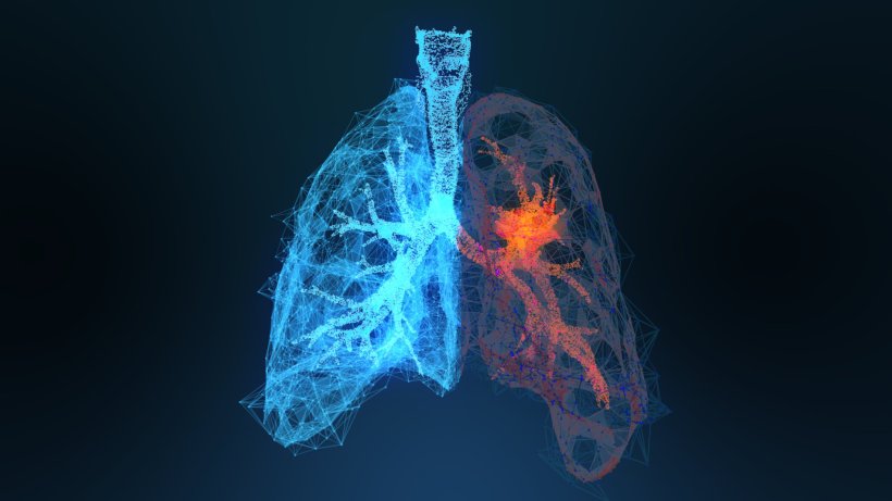 Streamlining lung cancer radiotherapy with Deep Learning
