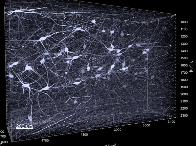 Noradrenergic neurons of the human locus coeruleus shell in three dimension.