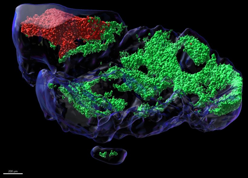 Tumor cells (red) grown within a microstructure (host tissue; green), a...
