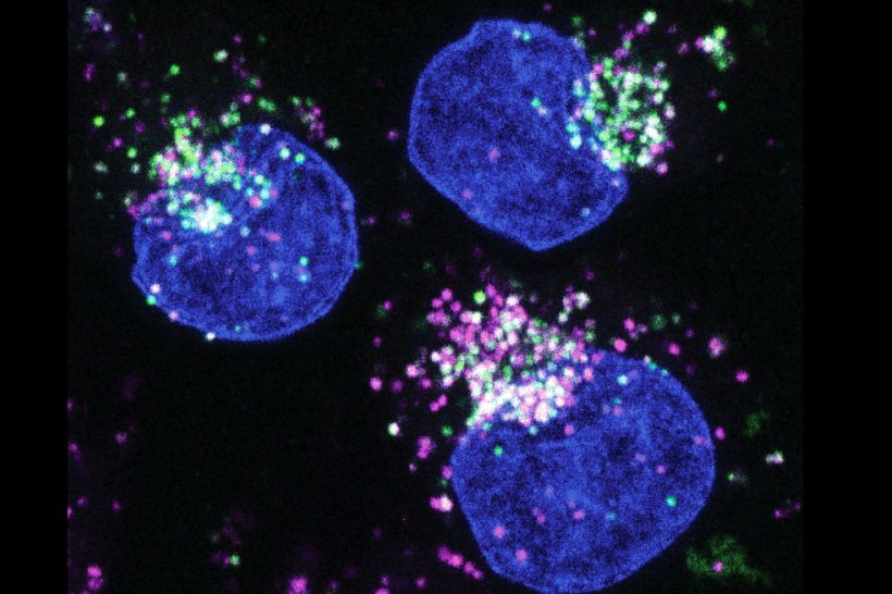 Menschliche Krebszellen (blau: Zellkerne) nehmen extrazelluläre Proteine auf...