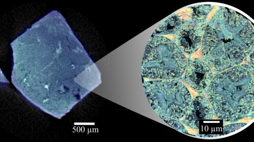 Microscopic (left) and high-resolution intracellular iodine distribution...