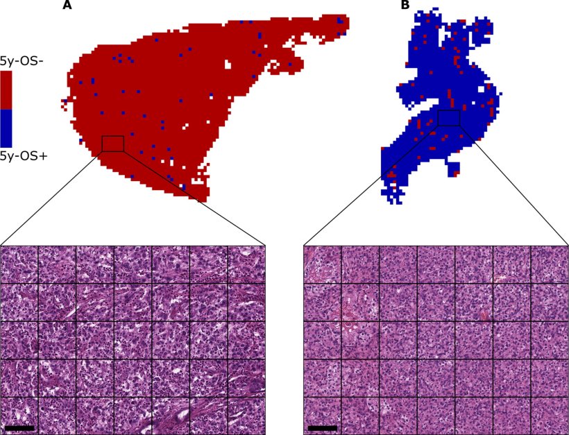 Two prediction maps of slides that the CNN prognosticated correctly with high...