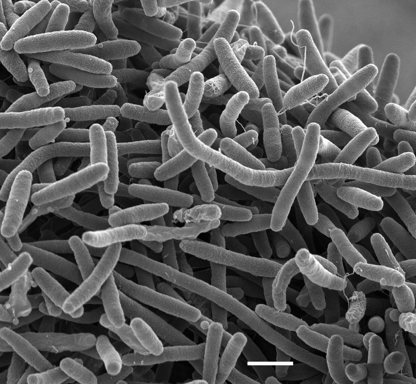 Legionella pneumophila under the scanning electron microscope. Scale bar = 1 µm