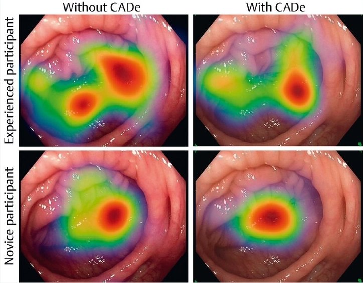 Heat map showing the eye movements of experienced (top row) and novice (bottom...