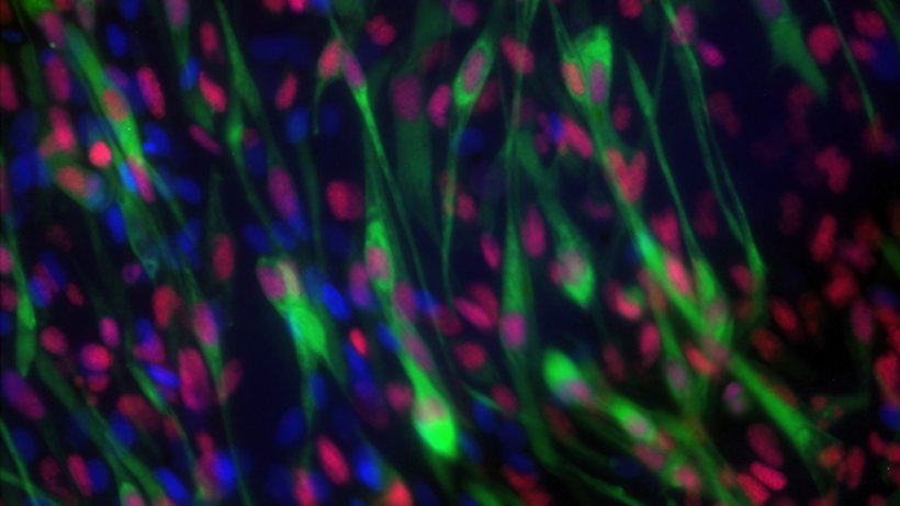 Rhabdomyosarcoma cells