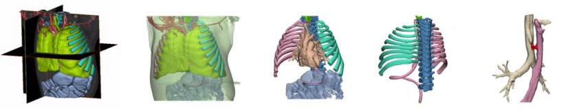 Workflow of the 3D print