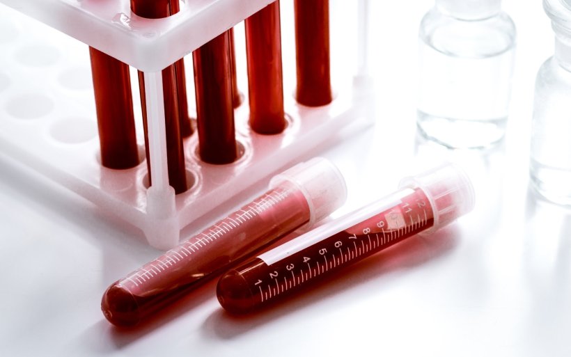 blood samples in glass tubes