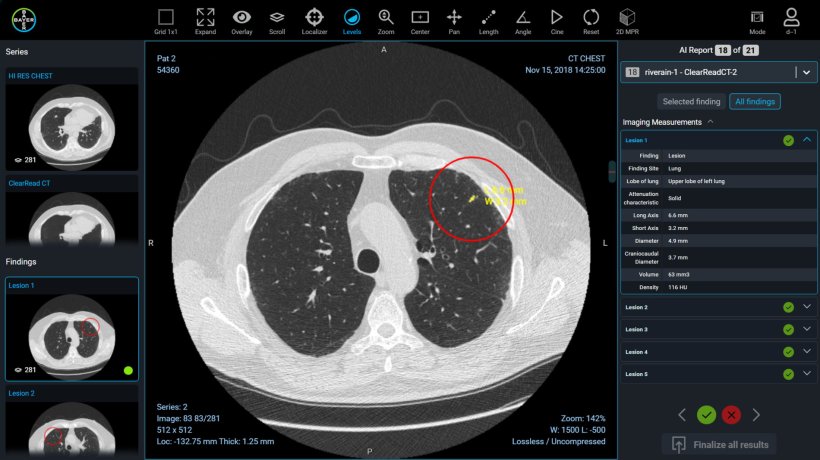 Images for illustrative purposes only; simulated data and patient information