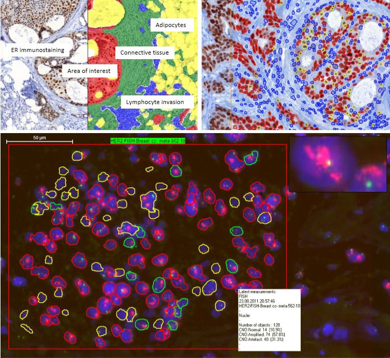 Figure 4: PatternQuant software allows automated identification of...