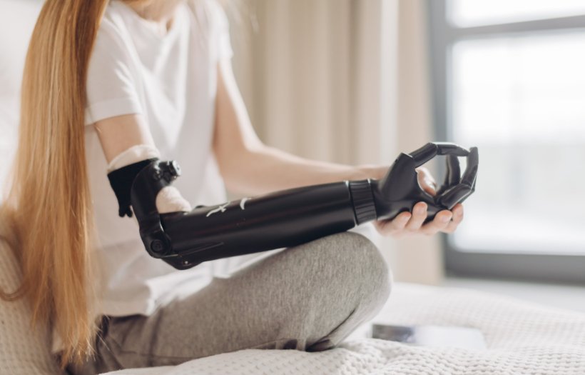 woman with dark robotic arm implant