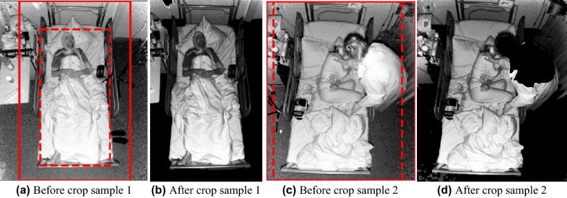 Examples of detection and crop, when the bed and the patient were properly...