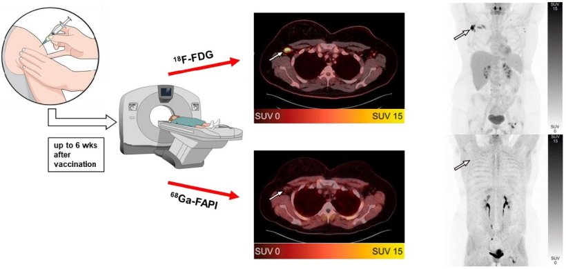 Graphical abstract of the new study