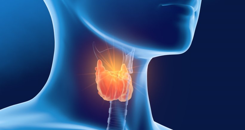 HIFU ablation treatment for benign thyroid nodules