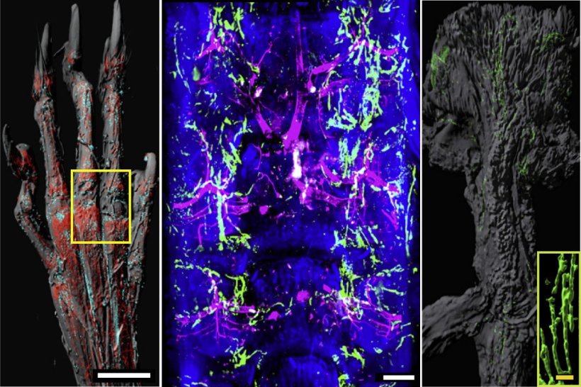 Light-sheet imaging of intact skeletal elements identifies lymphatic vessels in...