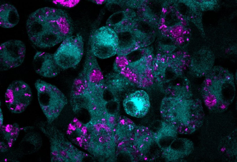 A confocal microscopy image of macrophages treated with MTX (cyan) that have...