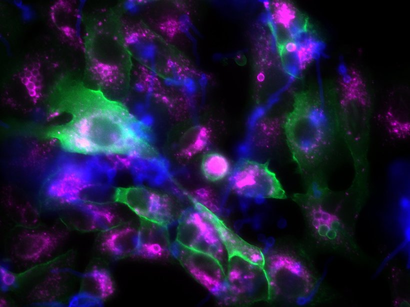 Das fluoreszenzmikroskopische Bild zeigt Epithelzellen (große, unregelmäßige...