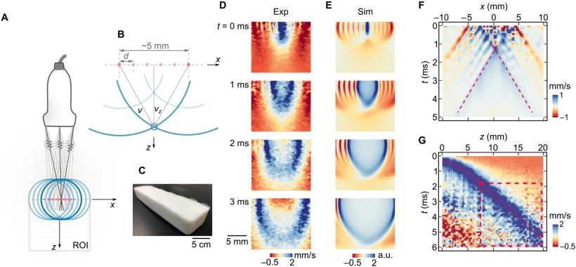 Acoustoelastic imaging using ultrasound shear wave elastography
