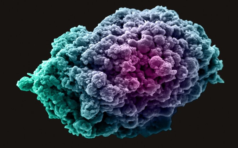 Breast cancer cell spheroid, SEM