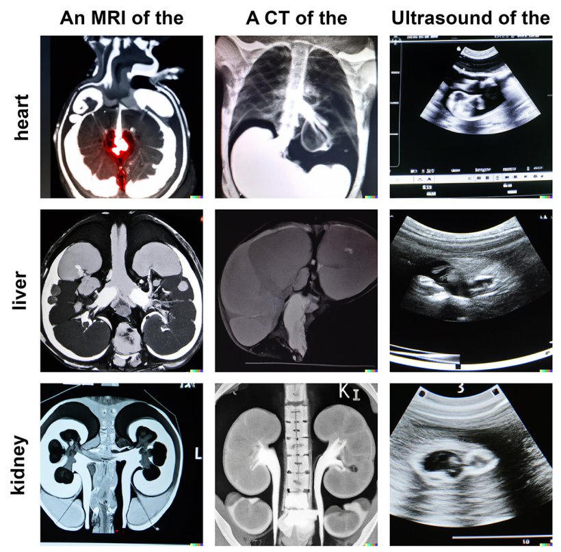 Examples of text-to-image–generated anatomical structures in CT, MRI, and...