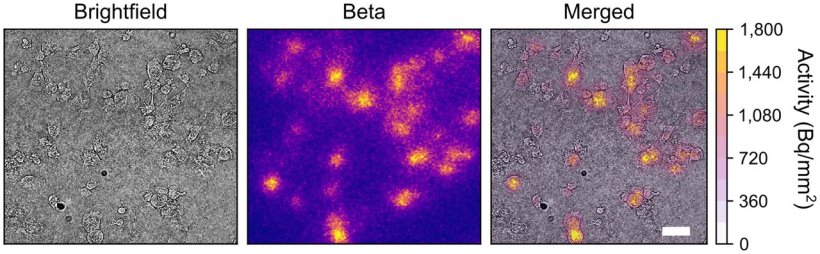 High-resolution beta imaging of 18F-FDG in breast cancer cells. MDA-MB-231...