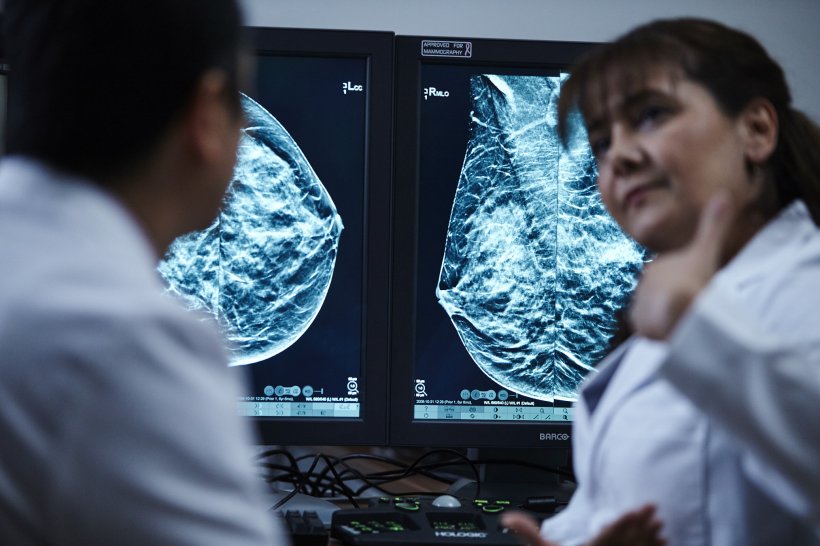 New EU recommendations for breast screening enhance opportunities for early...