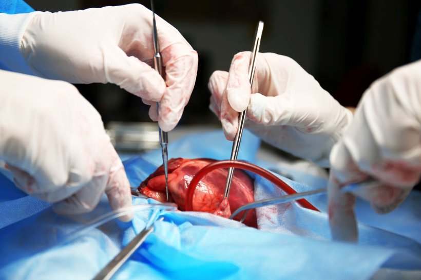Heart in a box - First beating-heart transplantation