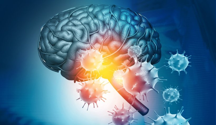 illustration of viruses attacking a human brain