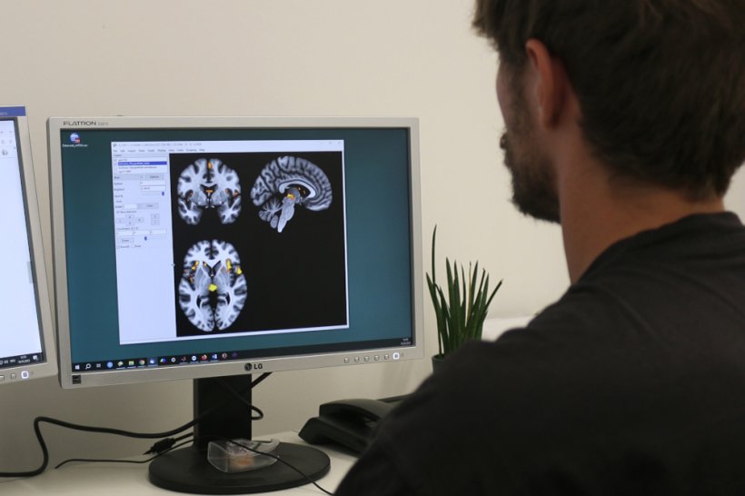Anhand von Daten aus Kernspintomografien konnten die Forscher die Gehirne von...