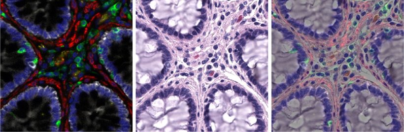 The Orion tool combines molecular details revealed by immunofluorescence...