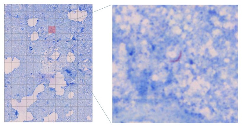 A digital microscopy scan showing the successful detection of TB