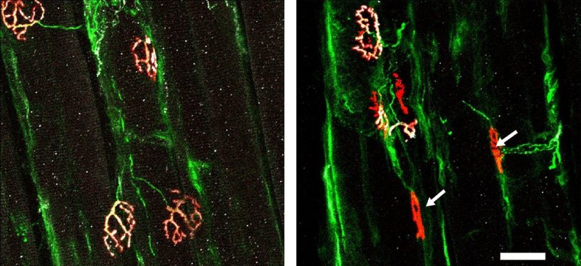 Die fluoreszenzmikroskopischen Aufnahmen zeigen Aufnahmen von Synapsen, die...