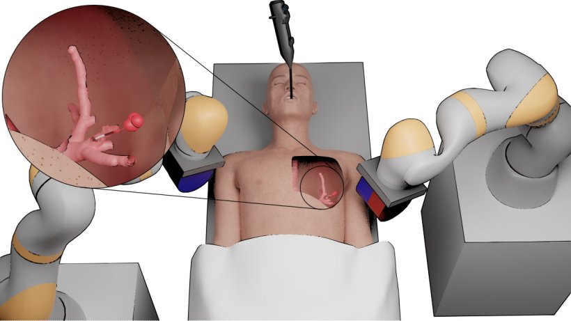 Robotic platform for peripheral lung tumour intervention based on magnetic...