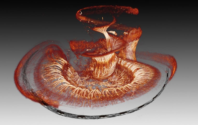 3D-Darstellung des Hörnervs in einer menschlichen Cochlea mit einer virtuell...