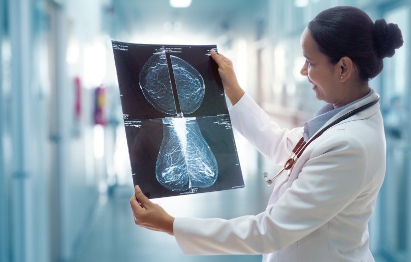 female doctor looking at mammogram