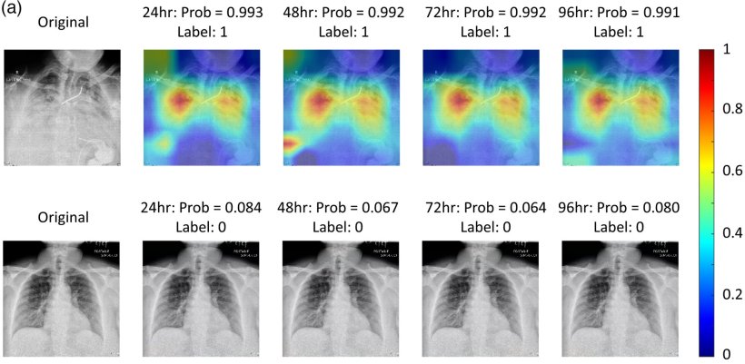 The proposed deep learning model utilizes chest x-ray radiography images to...