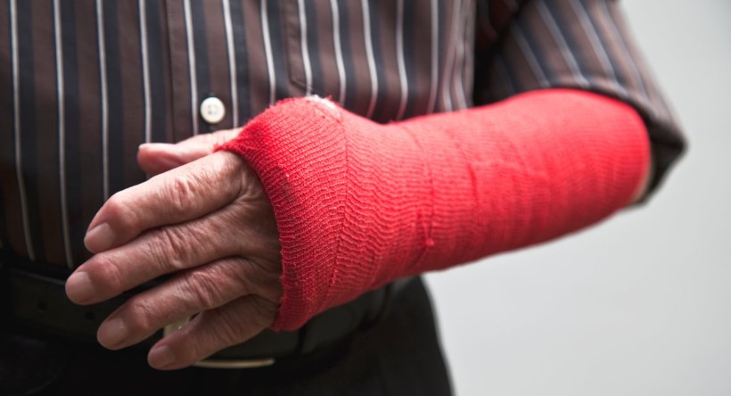 closeup photo of a mans broken arm in a red cast